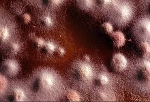 白癬菌のコロニー写真